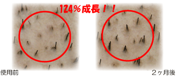 (左)使用前、(右)2ヶ月後