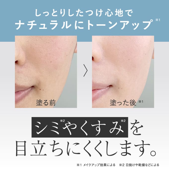 ハイドロキノン プラスシロクリームhq エクセレントメディカル本店