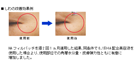 HAフィルパッチによる改善例 ナビジョン/HAフィルパッチ/しわ